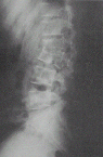 Spine